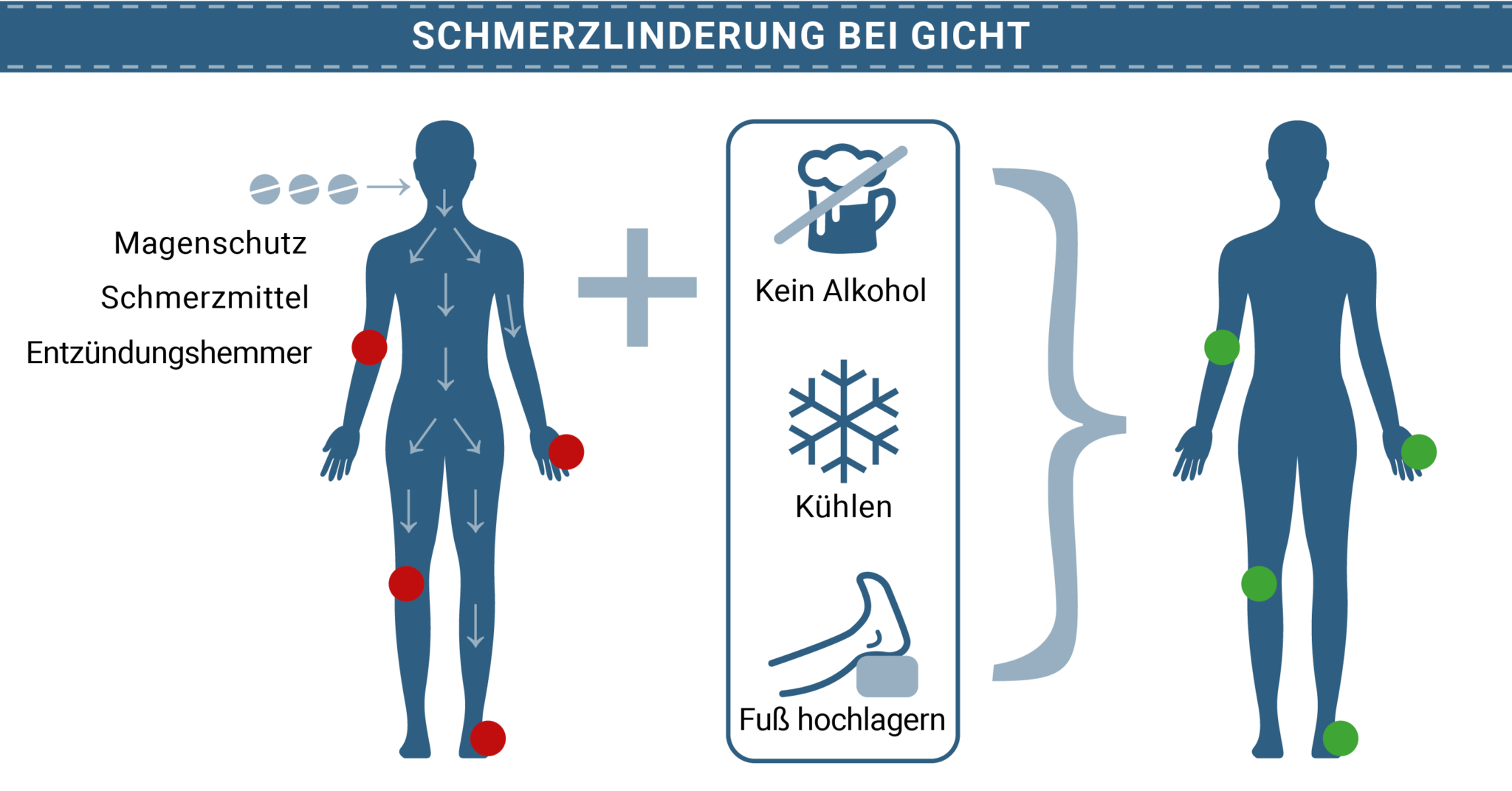 Gicht Medikamente - Was Sollte Man Beachten?