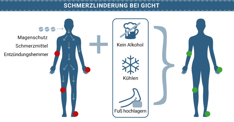 Bei Gicht Wärme Oder Kälte