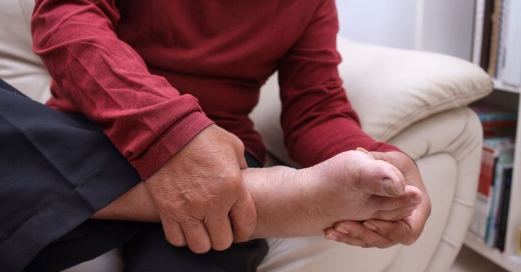 Person hält einen schmerzenden und geschwollenen Fuß – typische Beschwerden bei einem akuten Gichtanfall.